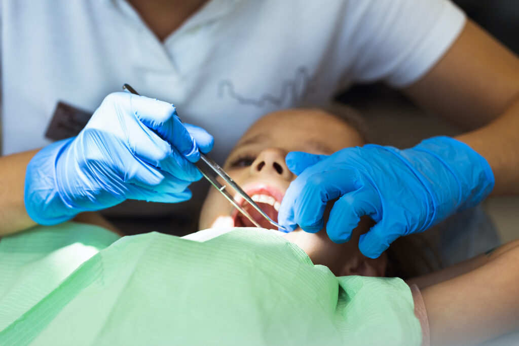 Kids and Cavities: What Parents Need to Know