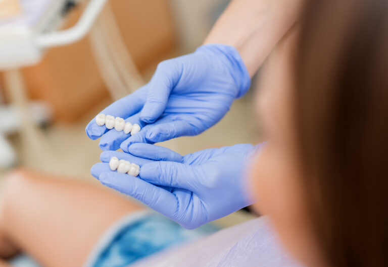 Crowns, Caps, and Veneers