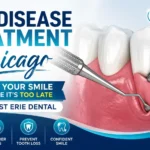 Gum Disease Treatment Chicago Save Your Smile Before It's Too Late