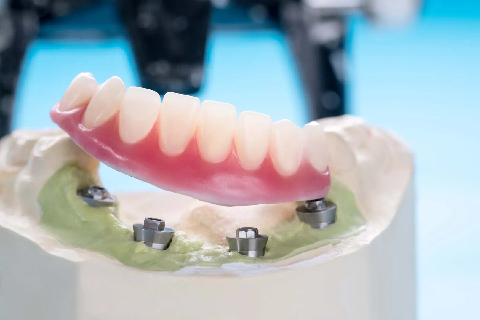 Why Chicago Patients Trust East Erie Dental Why Chicago Patients Trust East Erie Dental