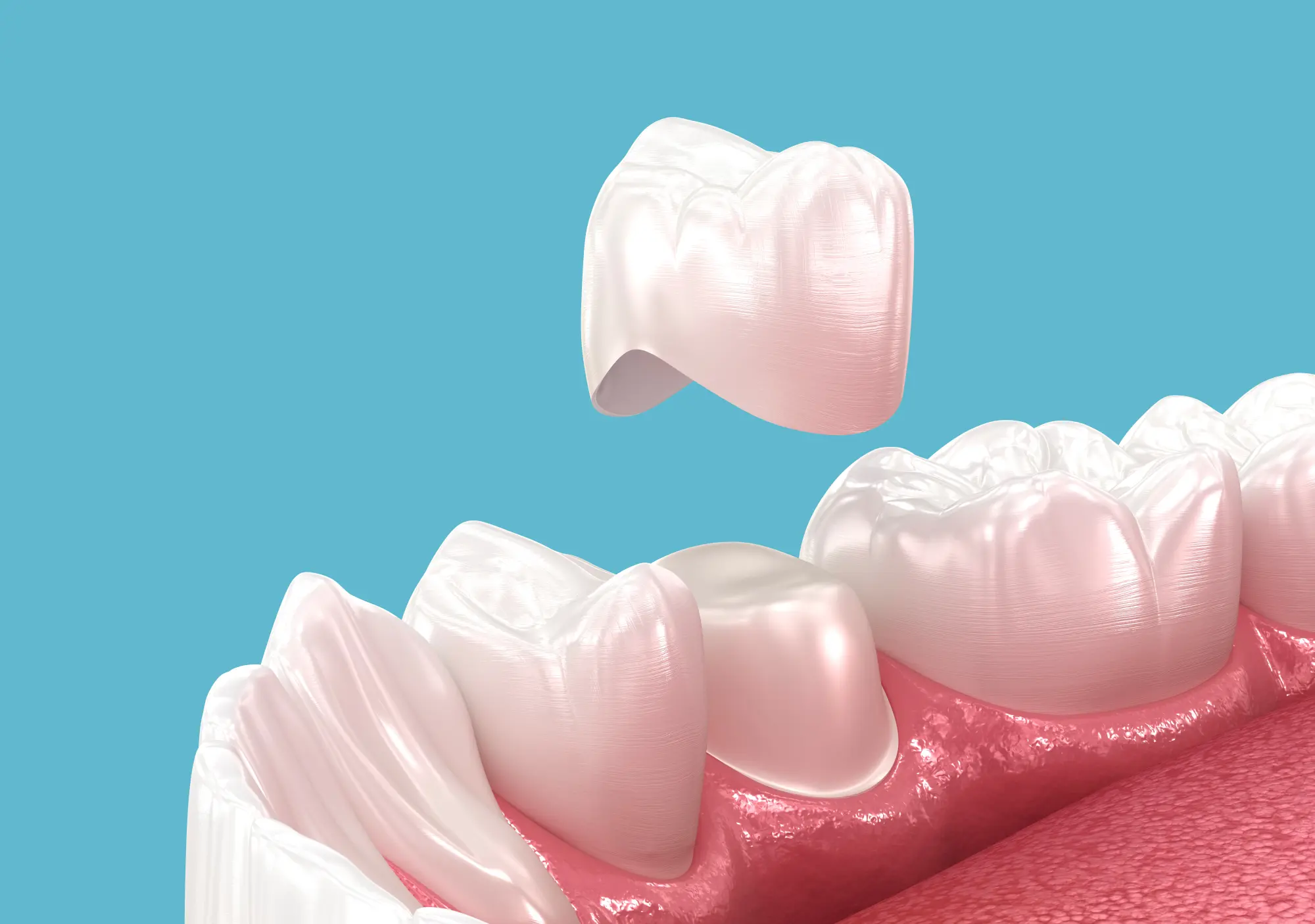 Why Choose East Erie Dental for Dental Crowns in Chicago? Why Choose East Erie Dental for Dental Crowns in Chicago?