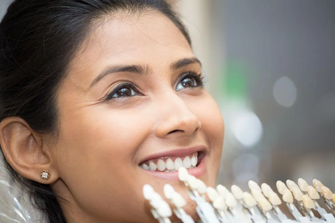 Benefits of Veneers Benefits of Veneers