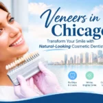 Veneers in Chicago Transform Your Smile with Natural-Looking Cosmetic Dentistry